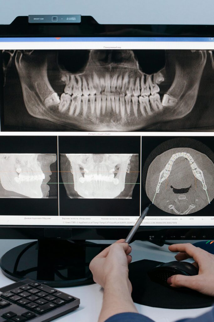 A dental professional examining an X-ray image of a jawbone on a computer monitor with a pointing device.